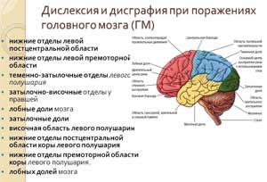 НЕЙРОПСИХОЛОГИЧЕСКИЕ МЕХАНИЗМЫ ДИСЛЕКСИИ