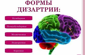 «ДИЗАРТРИЯ»