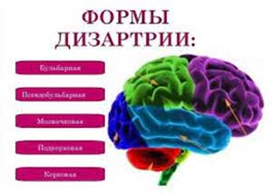 Консультация для родителей и воспитателей «Дизартрия. Что это такое?»
