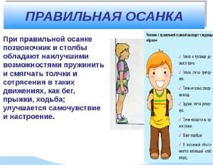 Семинар – практикум для родителей «Как предупредить нарушение осанки и плоскостопия?»